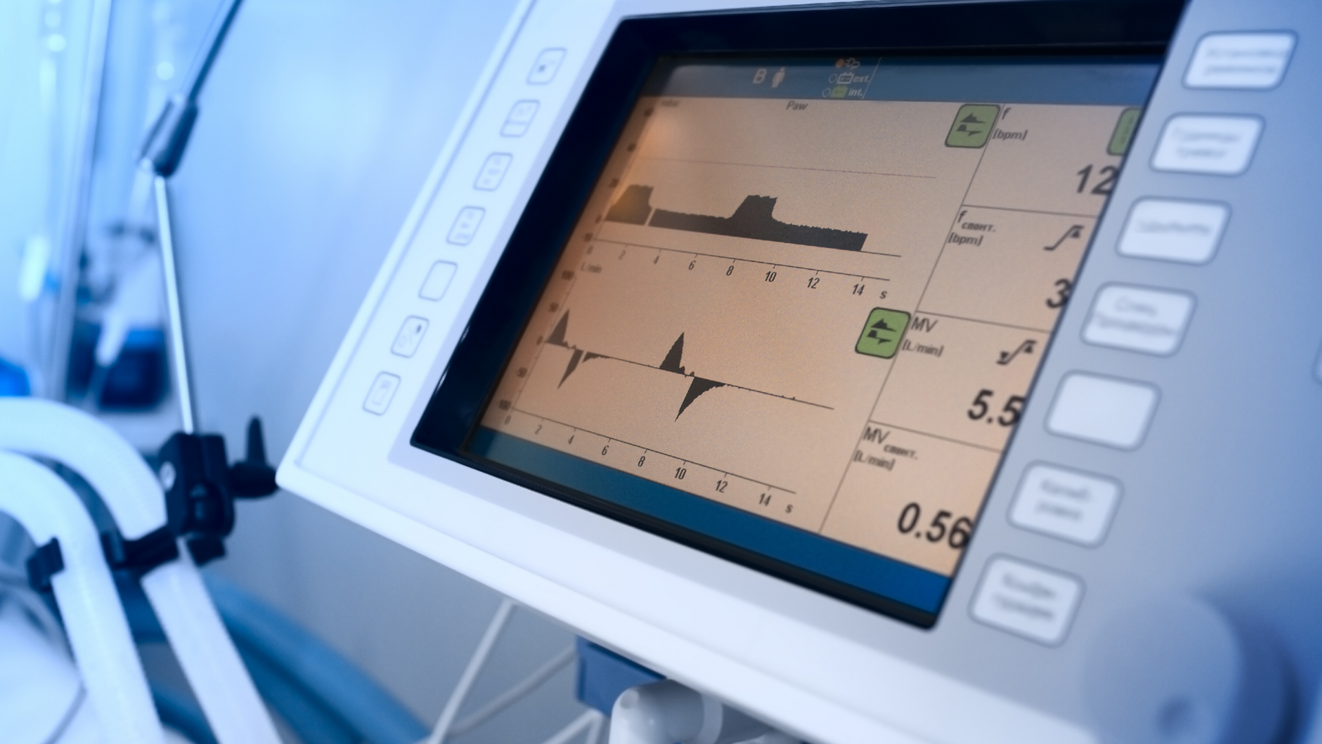 Ventilación mecánica